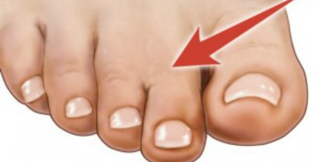 Imate li i vi ''GRČKO STOPALO''? Pogledajte šta to znači! 