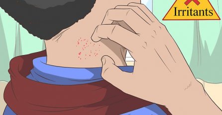 ZNATE LI ZAŠTO VAM SE JAVLJAJU BOBULJICE PO VRATU: Evo kako ćete ih se riješiti!