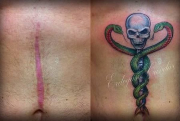 a98541-tattoo-scars-10-622x417
