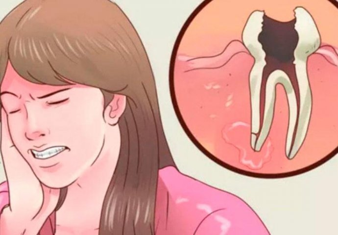 PROVJERENO: Ovo je najbolji lijek protiv zubobolje, DJELUJE ISTOG TRENUTKA!