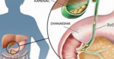 RAK NIKADA NIJE PRVA BOLEST, DREVNA KINESKA MEDICINA UPOZORAVA: Ako se u organizmu ovo pojavi, čeka vas kobna bolest!