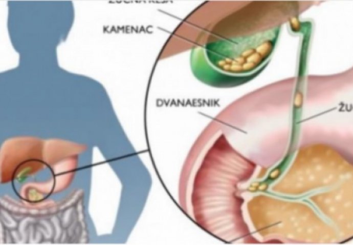 RAK NIKADA NIJE PRVA BOLEST, DREVNA KINESKA MEDICINA UPOZORAVA: Ako se u organizmu ovo pojavi, čeka vas kobna bolest!