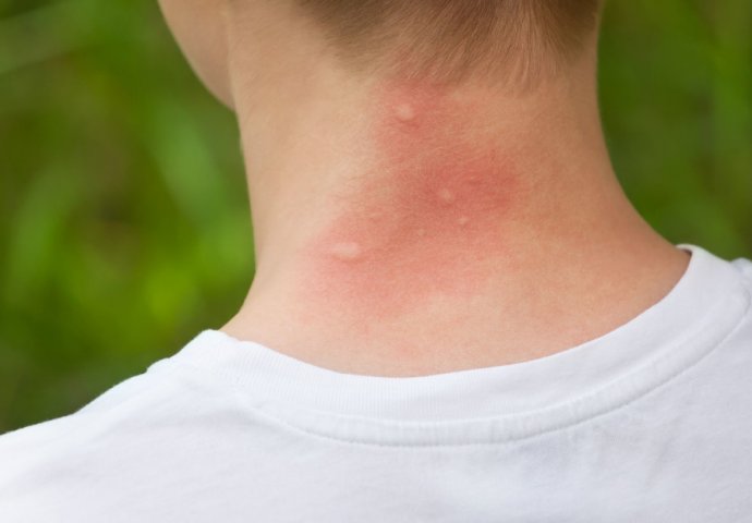 Isijecite ovo VOĆE na pola i stavite u sobu: Više nikada nećete vidjeti komarce!