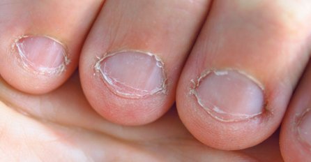 GRICKAO JE NOKTE, A ONDA MU JE PRST POČEO BUBRITI: Otac dvoje djece jedva ostao živ!