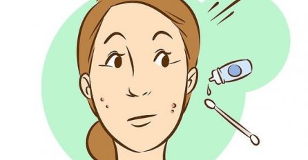 OVAJ HORMONSKI POREMEĆAJ SE JAVLJA KOD SVE VEĆEG BROJA ŽENA: Ovo su simptomi, odmah provjerite