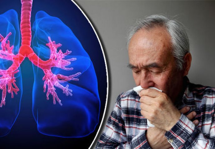 BUDITE OPREZNI: Ovo su prvi simptomi raka pluća, SVI MISLE DA JE BEZAZLENO