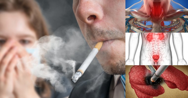 cancer-caused-secondhand-smoke