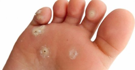 UKLONITE KURIJE OKO ZA SAMO 2 DANA: Ne bacajte pare, LIJEK JE U VAŠOJ KUĆI CIJELO VRIJEME