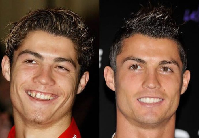 23 fotografije poznatih prije i poslije koje dokazuju da zubi mogu promjeniti izgled cijelog lica!