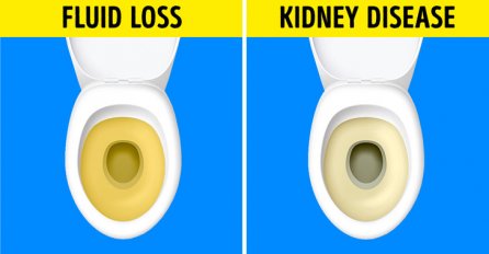 PROMJENA BOJE URINA, OSJEĆAJ NADUTOSTI: Ovih 7 znakova ukazuje da jedete previše soli