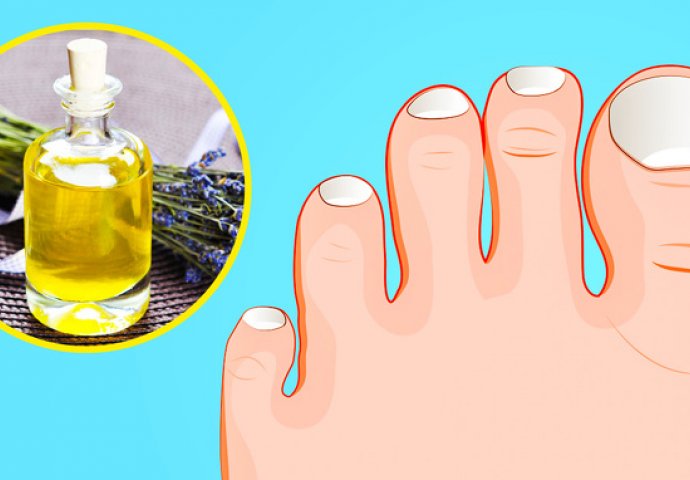 POTOPITE NOGE U OVU MJEŠAVINU: Zauvijek se riješite gljivičnih infekcija na vašim stopalima, GENIJALAN SAVJET