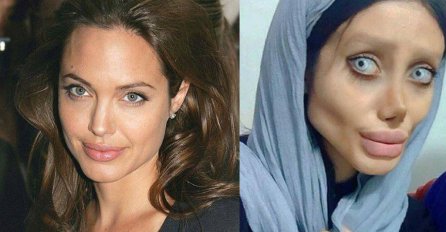 Ova djevojka je prošla kroz 50 operacija samo da bi izgledala kao njen idol "Angelina Jolie", ali...