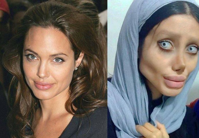 Ova djevojka je prošla kroz 50 operacija samo da bi izgledala kao njen idol "Angelina Jolie", ali...