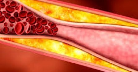 ČINI ČUDA: Gutljaj ovog prirodnog lijeka čisti začepljene vene, koronarne arterije, ali i jetru!