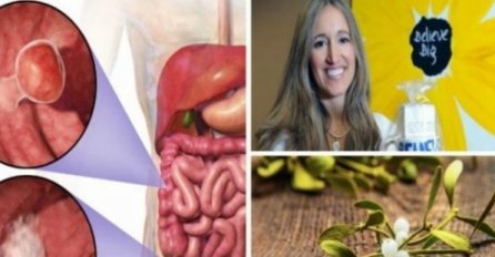 Žena odbila hemoterapiju i uspješno izliječila RAK DEBELOG CRIJEVA pomoću ove biljke - DOKTORI IZNENAĐENI