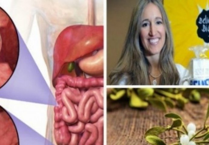 Žena odbila hemoterapiju i uspješno izliječila RAK DEBELOG CRIJEVA pomoću ove biljke - DOKTORI IZNENAĐENI