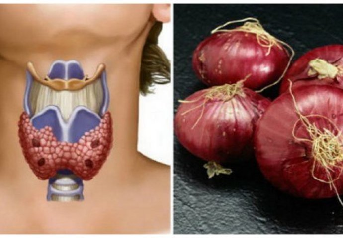 Nevjerovatan lijek: Stavite CRVENI LUK na vrat i pobijedite JEDNU OD NAJČEŠĆIH BOLESTI DANAŠNJICE!