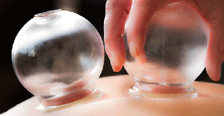 METODA STARA 1.400 GODINA: Znate li šta sve liječi hidžama?