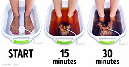 IZBACITE SVE OTROVE IZ ORGANIZMA: Za 30 minuta svi TOKSINI će izaći iz vašeg tijela kroz stopala!