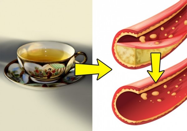 20172960-23760210-img2-0-1519283880-1519283887-1500-1-1519283887-650-0247ec11be-1519806953