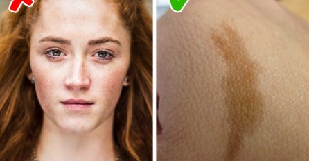 Opasni mitovi o mladežu i sunčanju u koji čak i neki doktori veruju