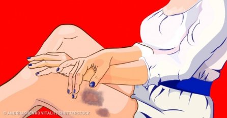 Imate OVE mrlje na tijelu: Evo koji zdravstveni problema mogu biti razlog