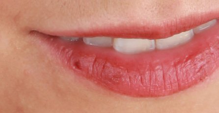 RIJEŠITE SE HERPESA PREKO NOĆI: Primijenite ovaj jednostavan trik i herpes će nestati za 12 sati!