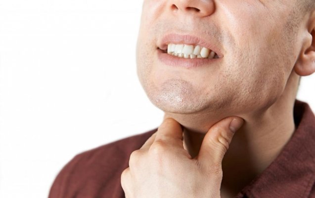throat-ulcers