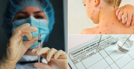 DUBROVNIK: Dvoje djece i beba zaraženi ospicama