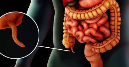 NI SLUČAJNO NE IGNORIŠITE OVE SIMPTOME: Ako ovo primijetite, USKORO ĆE VAM PUĆI SLIJEPO CRIJEVO!