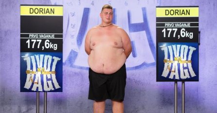 DORIAN IZ "ŽIVOTA NA VAGI" DRASTIČNO SMRŠAO, PA SE RIJEŠIO VIŠKA KOŽE: Nećete doći sebi kad vidite kako sada izgleda (FOTO)