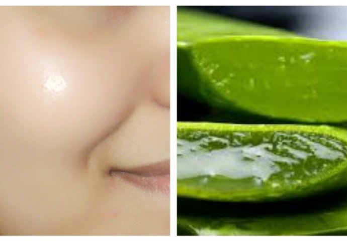 Koristi aloje su svima dobro poznate: Ne morate bacati novac na skupe preparate, evo kako da napravite ''čarobnu'' kremu!