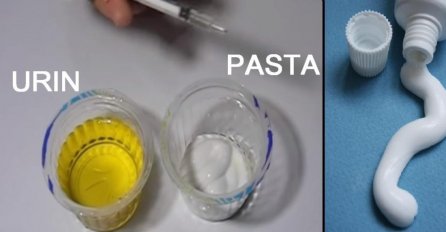 AKO ŽELITE SAZNATI JESTE LI TRUDNI, TREBA VAM SAMO PASTA ZA ZUBE: Evo kako je upotrijebiti, ne treba vam TEST!