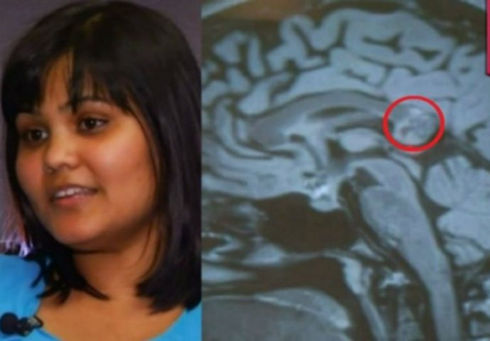 JEZIV SLUČAJ: Imala je problema sa vidom, a onda su joj u mozgu našli OVO! (VIDEO)