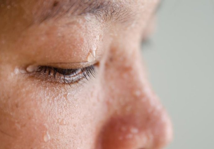 BUDITE SA ZNOJEM NA LICU: Evo na koju bolest ukazuje često znojenje