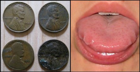 DA LI STE NEKADA OSJETILI OKUS METALA U USTIMA? To ukazuje na OVAJ OZBILJAN ZDRAVSTVENI PROBLEM, evo šta je u pitanju