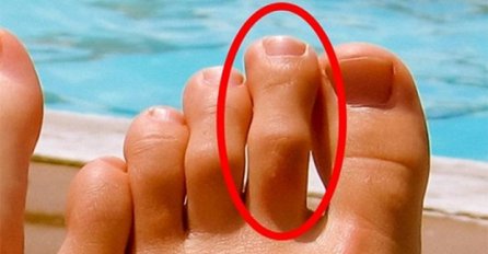 SKINITE ČARAPE I POGLEDAJTE: Ako vam je DRUGI prst duži od svih ostalih, onda biste OVO morali da znate 