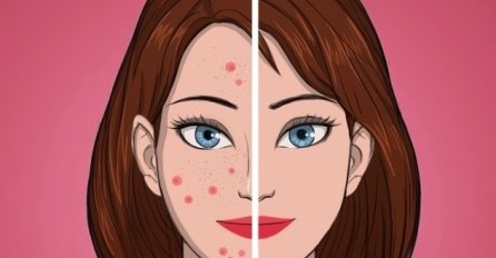 OVO SVI RADITE SVAKI DAN: Evo koje navike trajno RAZARAJU kožu lica