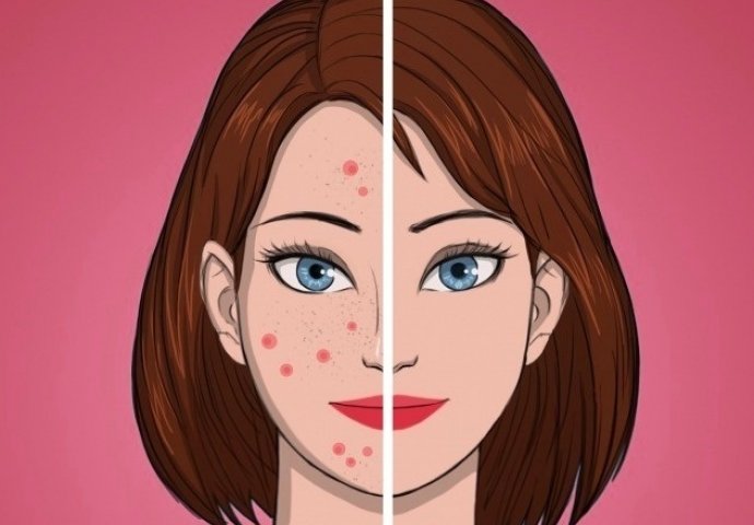 OVO SVI RADITE SVAKI DAN: Evo koje navike trajno RAZARAJU kožu lica