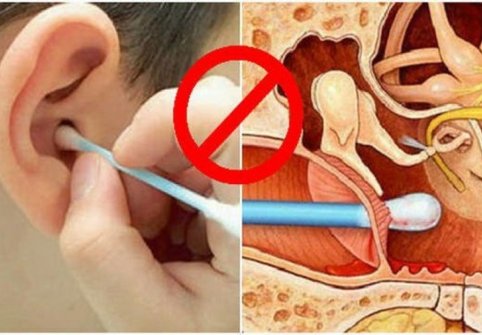 ZABORAVITE ŠTAPIĆE! Ovaj je liječnik otkrio genijalan trik za čišćenje ušiju (VIDEO)
