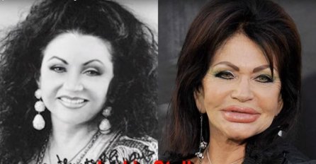 MUŠKARCI SU JOJ SE BACALI POD NOGE, BILA JE PRELIJEPA , A SADA JE NIKO NE PREPOZNAJE: Jedva pomjera lice, svi su se ZAPREPASTILI, NA ŠTA OVO LIČI! A tek oni...FOTO