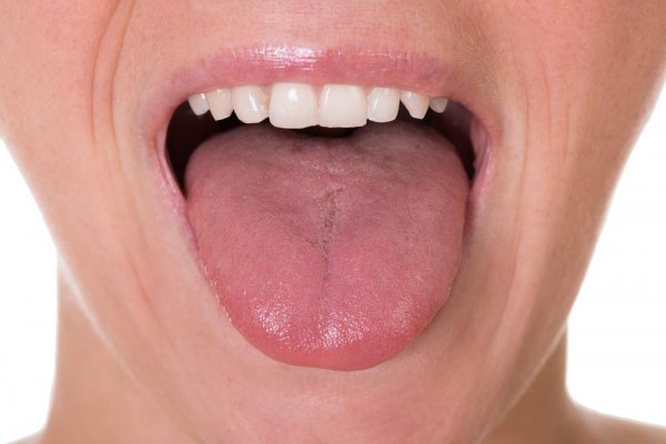 the-first-5-symptoms-of-tongue-cancer