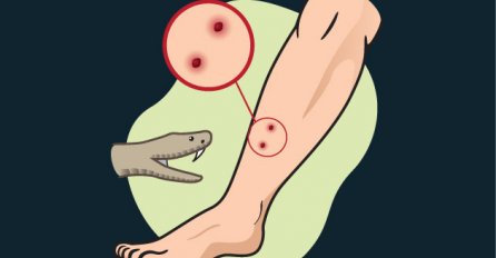 OVO VAM MOŽE SPASITI ŽIVOT: Naučite kako razlikovati zmije otrovnice i njihov ugriz od neotrovnica