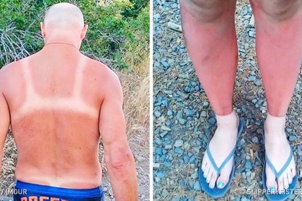 Znamo da boli: Ove slike su dokaz da i Sunce ima smisao za humor ...