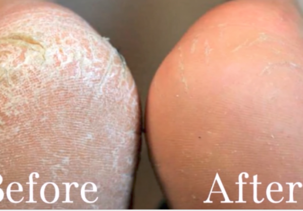 5ae0bb91-eb58-4a2f-9426-301a0a0a0a67-peete-690x480