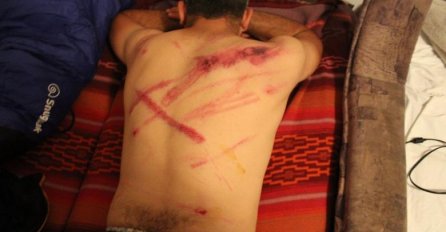 OBJAVLJENE POTRESNE FOTOGRAFIJE: 'Ovako mu izgledaju leđa nakon susreta s hrvatskom policijom'