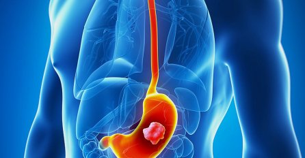 JOŠ JEDNA SRPSKA ZVIJEZDA OPERISALA ŽELUDAC, PA ZAGLAVILA U BOLNICI: Evo o kome je riječ, ne možete ni pretpostaviti!