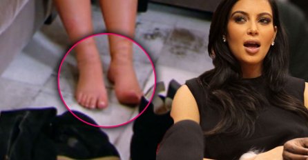 Poznate ličnosti koje boluju od opasnih bolesti (nismo mogli da vjerujemo kada smo vidjeli od čega pati broj #7)