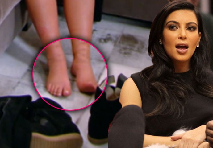 Poznate ličnosti koje boluju od opasnih bolesti (nismo mogli da vjerujemo kada smo vidjeli od čega pati broj #7)