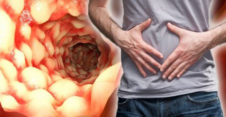 SVIMA PRIJETI OPASNO OBOLJENJE, PUŠAČI SU NAJUGROŽENIJI: Ova dva znaka ukazuju na OPAKO OBOLJENJE!